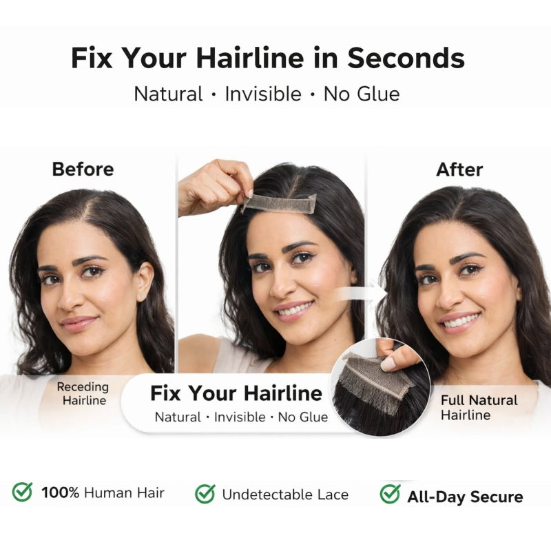 💁‍♀️Instantly Fix Your Hairline — No One Will Ever Know