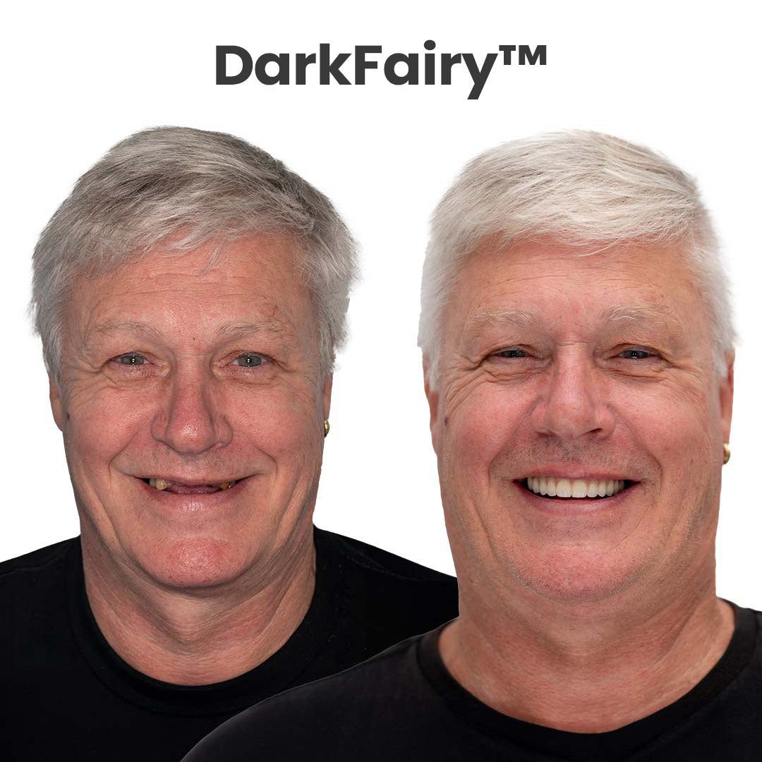 🦷DarkFairy™ Custom-Fit Dentures ⏰ ENDS TODAY   70% OFF | Smile with Confidence⚡
